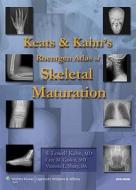 Keats And Kahn\'s Roentgen Atlas Of Skeletal Maturation di S. Lowell Kahn, Cree M. Gaskin, Victoria L. Sharp edito da Lippincott Williams And Wilkins
