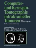 Computer- Und Kernspin-tomographie Intrakranieller Tumoren Aus Klinischer Sicht edito da Springer-verlag Berlin And Heidelberg Gmbh & Co. Kg