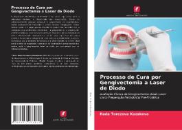 Processo de Cura por Gengivectomia a Laser de Diodo di Rada Torezova Kazakova edito da Edições Nosso Conhecimento