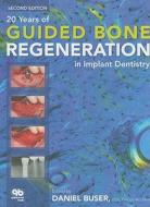 20 Years of Guided Bone Regeneration in Implant Dentistry edito da Quintessence Publishing (IL)