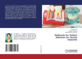 Rationale For Patient Selection For Dental Implants di M PRIYANTHI M, N DHINEKSH KUMAR N, DEVADOSS Vimal Joseph DEVADOSS edito da KS OmniScriptum Publishing