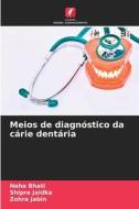 Meios de diagnóstico da cárie dentária di Neha Bhati, Shipra Jaidka, Zohra Jabin edito da Edições Nosso Conhecimento