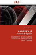 Alcoolisme et neuroimagerie di Sandra Chanraud edito da Editions universitaires europeennes EUE