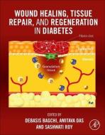 Wound Healing, Tissue Repair and Regeneration in Diabetes edito da ACADEMIC PR INC