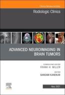 Advanced Neuroimaging in Brain Tumors, an Issue of Radiologic Clinics of North America, Volume 59-3 di Sangam Kanekar edito da ELSEVIER