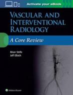 Vascular and Interventional Radiology: A Core Review di Brian Strife, Jeffrey Elbich edito da Lippincott Williams and Wilkins