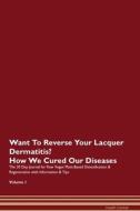 Want To Reverse Your Lacquer Dermatitis? How We Cured Our Diseases. The 30 Day Journal for Raw Vegan Plant-Based Detoxif di Health Central edito da Raw Power