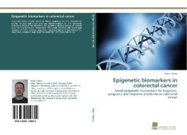 Epigenetic biomarkers in colorectal cancer di Marc Tänzer edito da Südwestdeutscher Verlag für Hochschulschriften AG  Co. KG