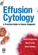 Effusion Cytology: A Practical Guide to Cancer Diagnosis di Parvin Ganjei-Azar, Merce Jorda, Awtar Krishan edito da DEMOS HEALTH