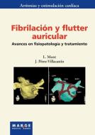 Fibrilación y flutter auricular di L. Mont Girbau edito da ICG Marge, SL