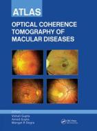 Atlas Of Optical Coherence Tomography Of Macular Diseases di Vishali Gupta, Amod Gupta, Mangat R. Dogra edito da Taylor & Francis Ltd