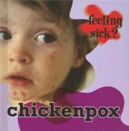 Chickenpox di Jillian Powell edito da Cherrytree Books
