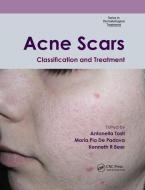Acne Scars edito da Taylor & Francis Ltd