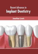 Recent Advances in Implant Dentistry di JONATHAN LEWIS edito da MURPHY & MOORE PUB