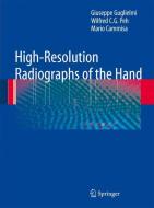 High-Resolution Radiographs of the Hand di Giuseppe Guglielmi, Wilfred C. G. Peh, Mario Cammisa edito da Springer-Verlag GmbH