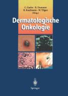 Dermatologische Onkologie edito da Springer Berlin Heidelberg