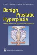 Benign Prostatic Hyperplasia edito da Springer Berlin Heidelberg