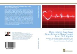 Sleep related Breathing Disorders and Sleep Stages from ECG Signals di Hans-Joachim Mörsdorf edito da Südwestdeutscher Verlag für Hochschulschriften AG  Co. KG
