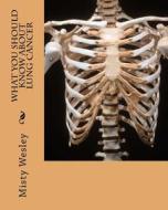 What You Should Know about Lung Cancer di Misty L. Wesley edito da Createspace