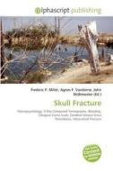 Skull Fracture edito da Betascript Publishing