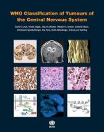 WHO Classification of Tumours of the Central Nervous System di International Agency for Research on Can edito da WORLD HEALTH ORGN
