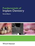Fundamentals of Implant Dentistry di Gerard Byrne edito da BLACKWELL PUBL