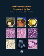 Who Classification of Tumours of the Eye edito da WORLD HEALTH ORGN