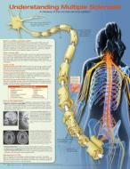 Understanding Multiple Sclerosis Anatomical Chart Laminated di Anatomical Chart Company edito da Lippincott Williams And Wilkins