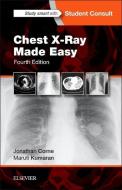 Chest X-Ray Made Easy di Jonathan Corne, Maruti Kumaran edito da Elsevier Health Sciences