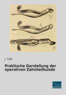 Praktische Darstellung der operativen Zahnheilkunde di J. Taft edito da Fachbuchverlag Dresden