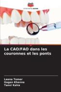 La CAO/FAO dans les couronnes et les ponts di Leena Tomer, Gagan Khanna, Tanvi Kalra edito da Editions Notre Savoir