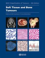 Soft Tissue and Bone Tumours di Who Classification of Tumours Editorial edito da WORLD HEALTH ORGN