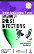 Clinico Radiological Series: Imaging of Chest Infections di Ashu Seith Bhalla, Manisha Jana, Priyanka Naranje edito da Jaypee Brothers Medical Publishers
