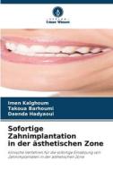 Sofortige Zahnimplantation in der ästhetischen Zone di Imen Kalghoum, Takoua Barhoumi, Daenda Hadyaoui edito da Verlag Unser Wissen