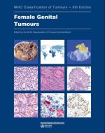 Female Genital Tumours: Who Classification of Tumours edito da WORLD HEALTH ORGN