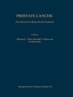 Prostate Cancer: New Horizons in Research and Treatment edito da Springer US