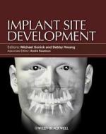 Implant Site Development di Michael Sonick edito da Wiley-Blackwell