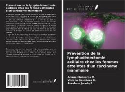 Prévention de la lymphadénectomie axillaire chez les femmes atteintes d'un carcinome mammaire di Ariana Molineros M., Viviana Gavilánez R., Abraham Jurado R. edito da Ediciones Nuestro Conocimiento
