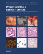 Urinary and Male Genital Tumours edito da WORLD HEALTH ORGN
