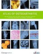 Atlas of Osteoarthritis di Nigel Arden, Francisco Blanco, Cyrus Cooper, Ali Guermazi, Daichi Hayashi, David Hunter edito da Springer-Verlag GmbH
