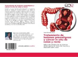 Tratamiento de lesiones premalignas y cáncer in situ de colon y recto di Yesael Descalzo García edito da EAE