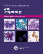Who Reporting System for Lung Cytopathology edito da WORLD HEALTH ORGN
