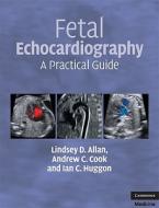 Fetal Echocardiography di Lindsey D. Allan edito da Cambridge University Press