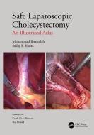 Safe Laparoscopic Cholecystectomy di Mohammad Ibrarullah, Sadiq S Sikora edito da Taylor & Francis Ltd
