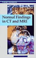 Normal Findings in CT and MRI, A1, print di Torsten Bert Möller, Emil Reif edito da Thieme Georg Verlag