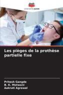 Les pièges de la prothèse partielle fixe di Pritesh Gangde, B. K. Motwani, Aakruti Agrawal edito da Editions Notre Savoir