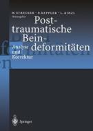 Posttraumatische Beindeformitäten edito da Springer Berlin Heidelberg