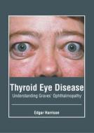 Thyroid Eye Disease: Understanding Graves' Ophthalmopathy edito da FOSTER ACADEMICS