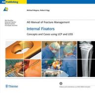 Ao Manual Of Fracture Management - Internal Fixators di Michael Wagner, Robert Frigg edito da Thieme Publishing Group