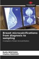 Breast microcalcifications: from diagnosis to sampling di Radia Benyahia, Chahira Mazouzi edito da Our Knowledge Publishing